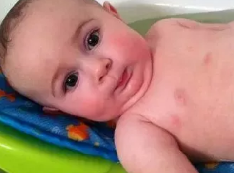 寶寶有鼻痂怎么清理2018 寶寶鼻塞怎么預防