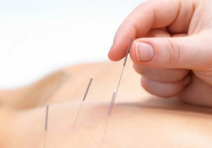 如何提高人工授精的成功率 針灸能提高人工授精成功率嗎