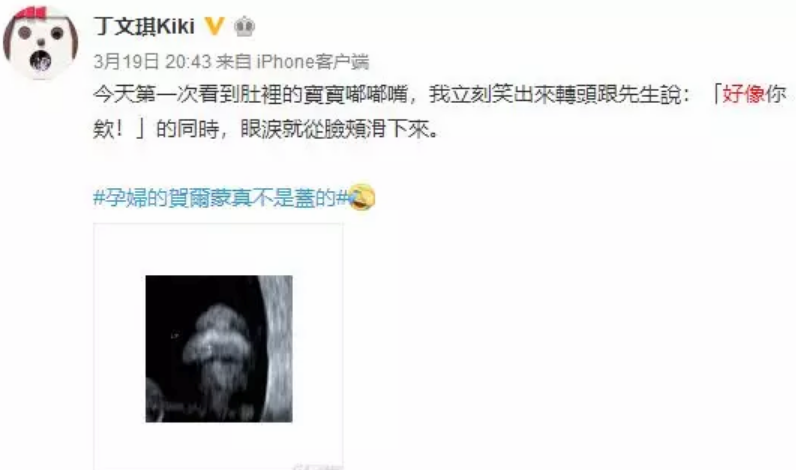 孕期衣食住行需要注意什么 孕晚期衣食住行攻略 孕期衣食住行需要注意什么 孕晚期衣食住行攻略