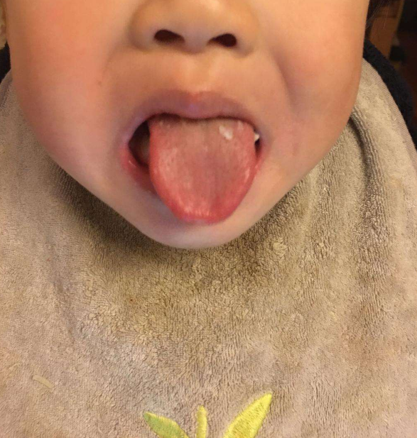 寶寶積食會怎么樣 2018寶寶積食有哪些危害