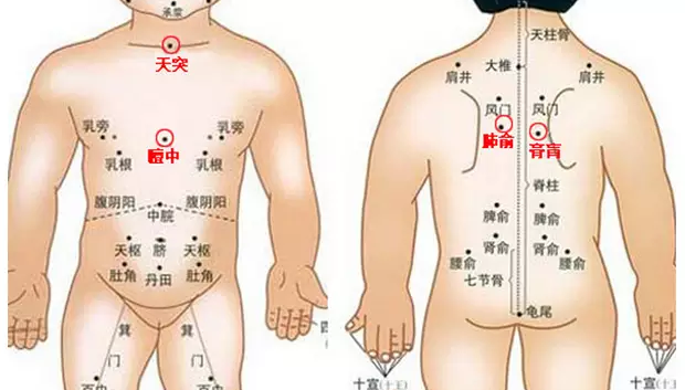 兒童貼三伏貼在哪些穴位好2018 小孩貼完三伏貼要注意什么