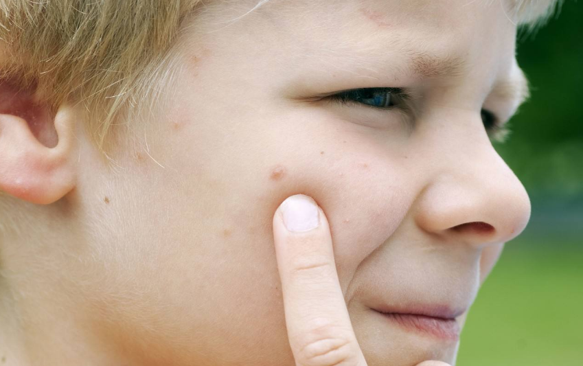 寶寶可以使用蚊香嗎 蚊子喜歡咬寶寶用什么方法驅蚊比較好2018