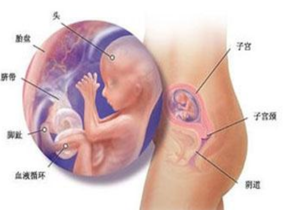 懷孕子宮肌瘤的常見癥狀 子宮肌瘤會引起不孕癥嗎 懷孕子宮肌瘤的常見癥狀 子宮肌瘤會引起不孕癥嗎