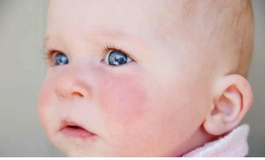 夏天寶寶先防曬還是防蚊 夏季怎么用防曬和防蚊用品