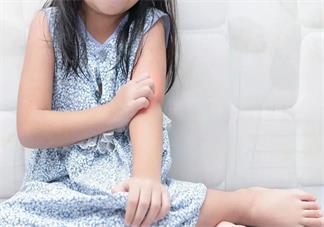 孩子夏天為什么會長痱子 孩子夏天長痱子怎么辦好2018