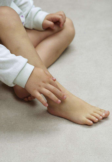 孩子被蚊蟲咬了之后怎么緩解 孩子蚊蟲咬后緩解方法