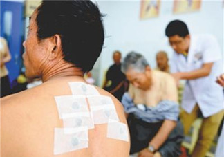 三伏貼什么時候貼最好 三伏貼不建議晚上貼