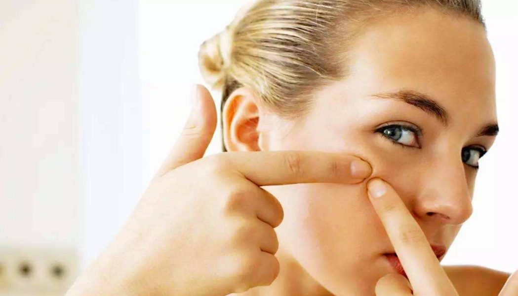 孕早期臉上長痘生男孩嗎 懷孕長痘痘生男生女 孕早期臉上長痘生男孩嗎 懷孕長痘痘生男生女