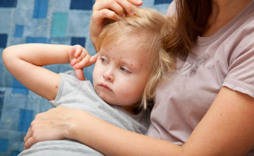 寶寶體質(zhì)與哪些因素有關(guān)系 夏季孩子可以貼三伏貼針灸嗎