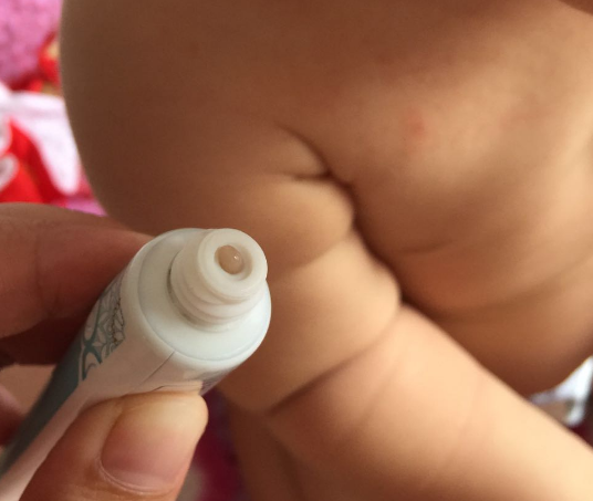 嬰寶濕癢膏怎么樣 嬰寶的寶寶止癢膏好用嗎