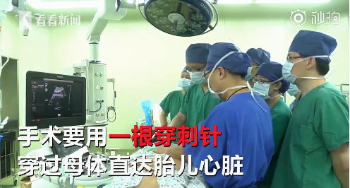 小孩在肚子里接受手術真的嗎 先天性心臟病在媽媽肚子里手術成功率高嗎 小孩在肚子里接受手術真的嗎 先天性心臟病在媽媽肚子里手術成功率高嗎