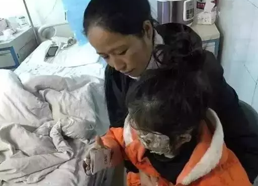 三星手機(jī)炸傷女童毀容 炸傷女童家屬索賠百萬