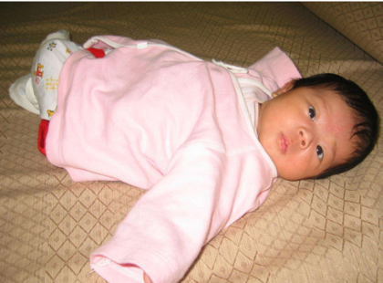 寶寶尿路感染怎么辦 如何預防女寶寶尿路感染