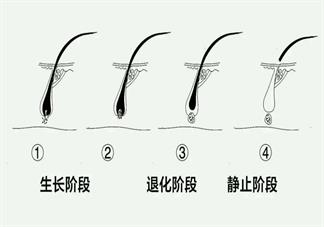 生完孩子之后為什么會出現脫發 產后脫發具體原因