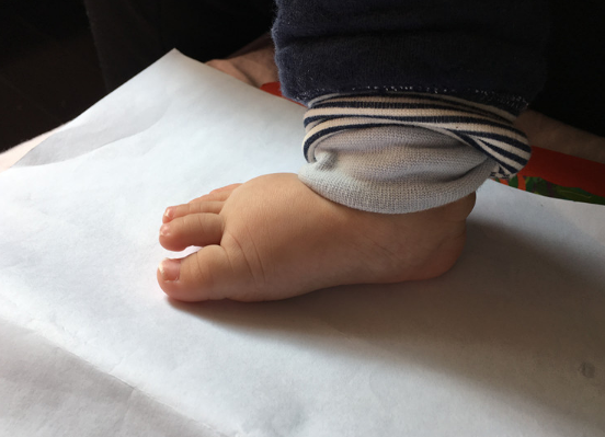 步前鞋和學步鞋區別是什么 寶寶需要準備步前鞋嗎