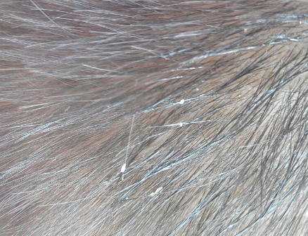 康麗賦嬰兒去頭垢油怎么樣 康麗賦嬰兒去頭垢油好用嗎