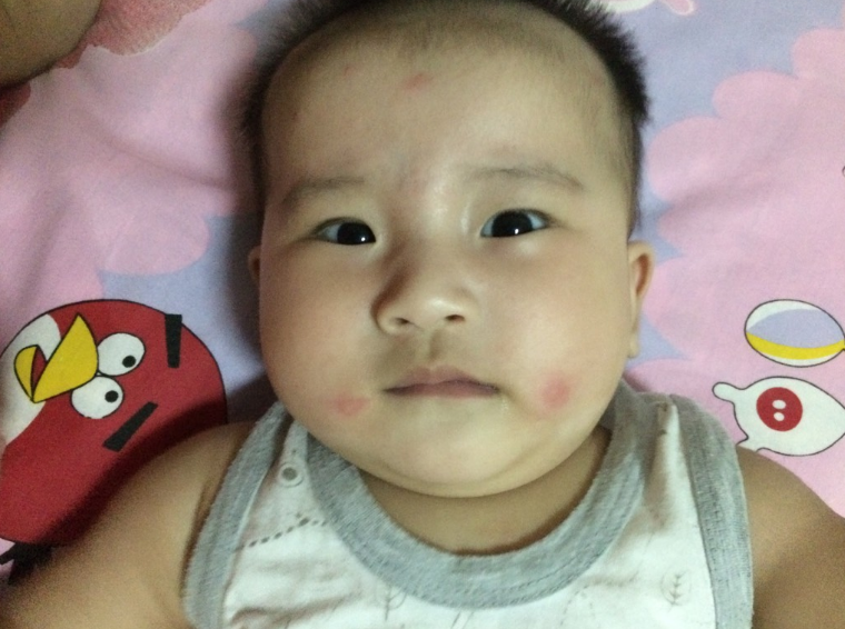 寶寶夏日如何避免蚊子叮咬 寶寶容易被蚊子咬怎么辦好 寶寶夏日如何避免蚊子叮咬 寶寶容易被蚊子咬怎么辦好