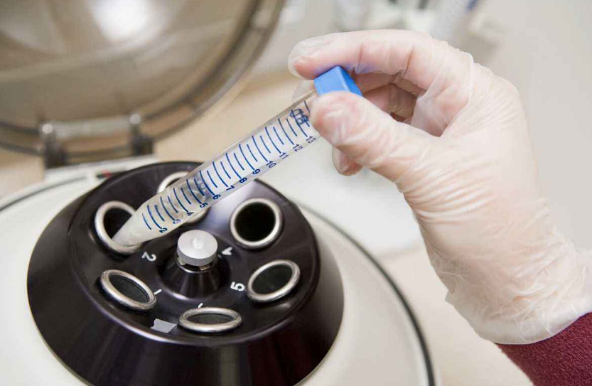 冷凍胚胎比冷凍卵子好嗎 冷凍胚胎最長可以存放多長時間