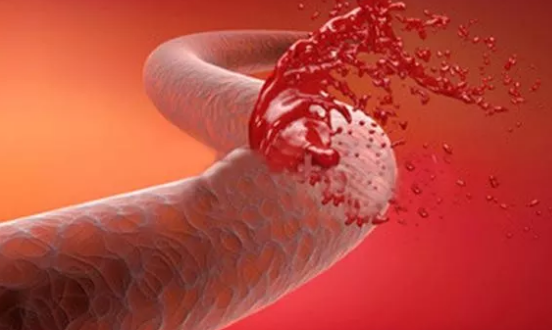 試管嬰兒移植后出血正常嗎 試管嬰兒出血和宮外孕有關嗎