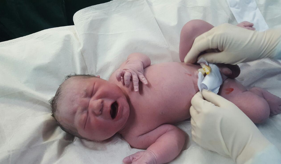 什么行為會污染羊水 羊水污染了會對胎兒產生什么影響