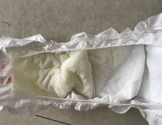 實爽嬰兒紙尿片適合夏天用嗎 實爽嬰兒紙尿片會紅屁股嗎