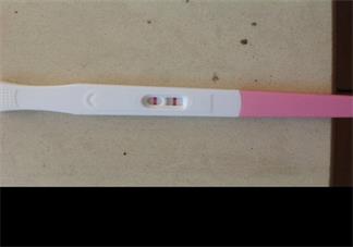 白帶增多就是婦科病嗎 正常的白帶是什么樣的