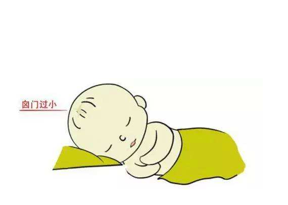 寶寶囟門凸起怎么回事 寶寶囟門什么情況不對勁 寶寶囟門凸起怎么回事 寶寶囟門什么情況不對勁
