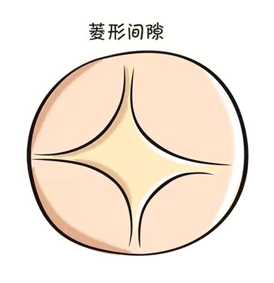 寶寶囟門凸起怎么回事 寶寶囟門什么情況不對勁 寶寶囟門凸起怎么回事 寶寶囟門什么情況不對勁