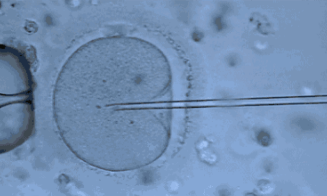 泰國試管嬰兒可以保證生男孩嗎 泰國試管嬰兒如何成功選擇性別