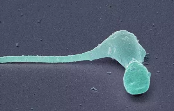 吃止疼藥對精液質量有影響嗎 吃止疼藥影響試管嬰兒備孕嗎