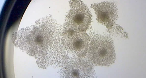 打達(dá)必佳期間發(fā)現(xiàn)懷孕了怎么辦 打了達(dá)必佳小孩能要嗎