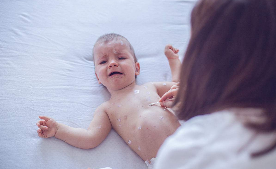 口服輪狀病毒疫苗真的有用嗎 嬰兒服用口服輪狀病毒疫苗必要嗎