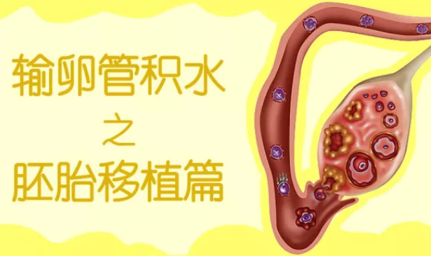 輸卵管有積水會(huì)影響胚胎移植嗎 輸卵管積水會(huì)影響胚胎移植成功率嗎
