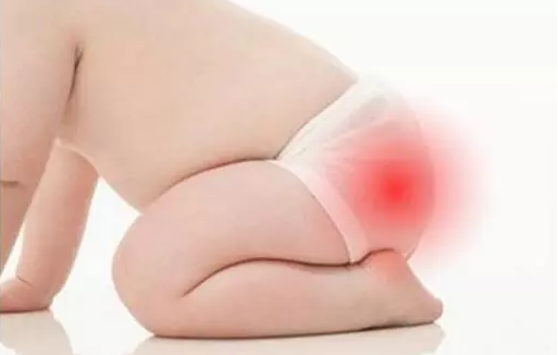 寶寶得了尿布疹怎么辦 尿布疹的防治方法