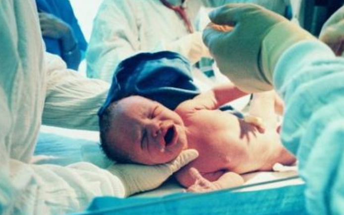 過期妊娠要催生嗎2018 哪些孕婦容易過期妊娠 過期妊娠要催生嗎2018 哪些孕婦容易過期妊娠