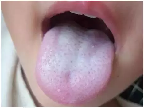 怎么知道孩子體內是否有濕氣 孩子體內濕氣如何判斷 怎么知道孩子體內是否有濕氣 孩子體內濕氣如何判斷