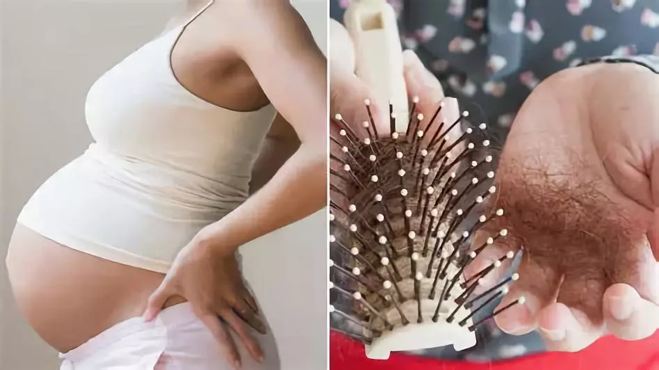 生完孩子多久后會掉頭發 生完孩子掉頭發的原因有哪些 生完孩子多久后會掉頭發 生完孩子掉頭發的原因有哪些