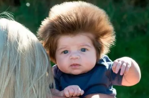 寶寶頭發又細又黃是遺傳原因嗎 寶寶頭發又細又黃吃什么好