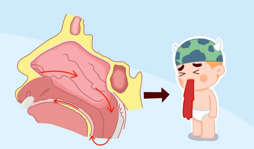 孩子流鼻血是什么原因導致的 怎么預防孩子流鼻血 孩子流鼻血是什么原因導致的 怎么預防孩子流鼻血