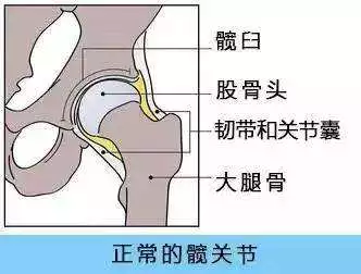 髖關(guān)節(jié)發(fā)育怎么排查有沒有問題 孩子髖關(guān)節(jié)發(fā)育問題檢查