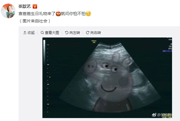 張歆藝預(yù)產(chǎn)期是什么時(shí)候 張歆藝預(yù)產(chǎn)期是幾月份