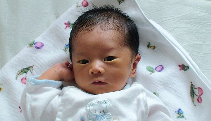 懷孕的時候要注意什么生出來的孩子不會黃疸 如何避免黃疸和胎毒 懷孕的時候要注意什么生出來的孩子不會黃疸 如何避免黃疸和胎毒