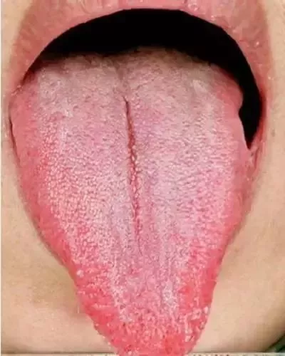 孩子肝不好怎么調理 孩子肝不好癥狀是什么