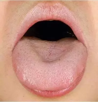 孩子肝不好怎么調理 孩子肝不好癥狀是什么