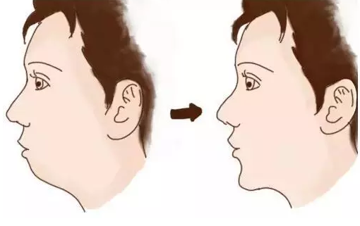 小七短發(fā)撞臉媽媽 孩子是更像父親還是更像母親