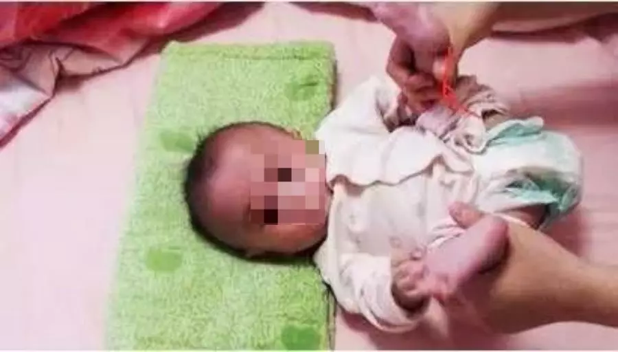 如何檢查寶寶肌張力是否正常 寶寶肌張力判斷方法