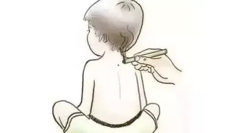 孩子咳嗽艾灸灸哪里 用艾灸可以治療現(xiàn)孩子咳嗽嗎