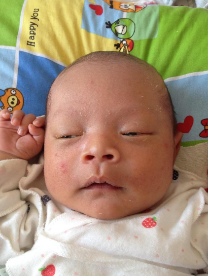 孩子睡醒后眼屎多是什么原因 孩子眼屎多是生病了嗎