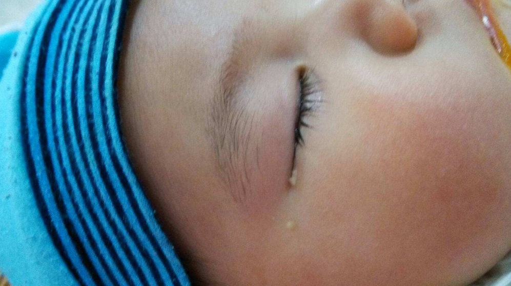 孩子睡醒后的眼屎怎么洗 用什么方法清洗眼屎