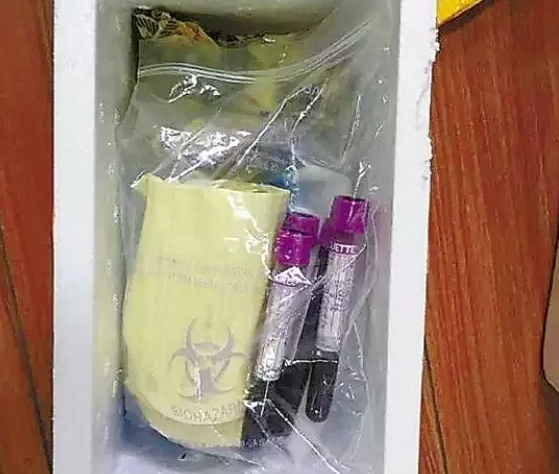 為什么香港性別鑒定合法 香港驗血查男女要注意什么